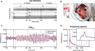 Exposure to bilingual or monolingual maternal speech during pregnancy affects the neurophysiological encoding of speech sounds in neonates differently